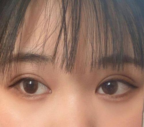 医院真人口碑评价怎么样?