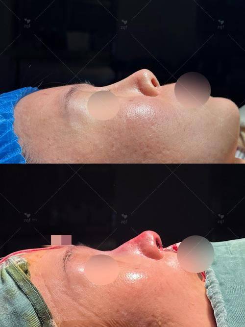 杭州优医联合医美详细的预约挂号方式及流程