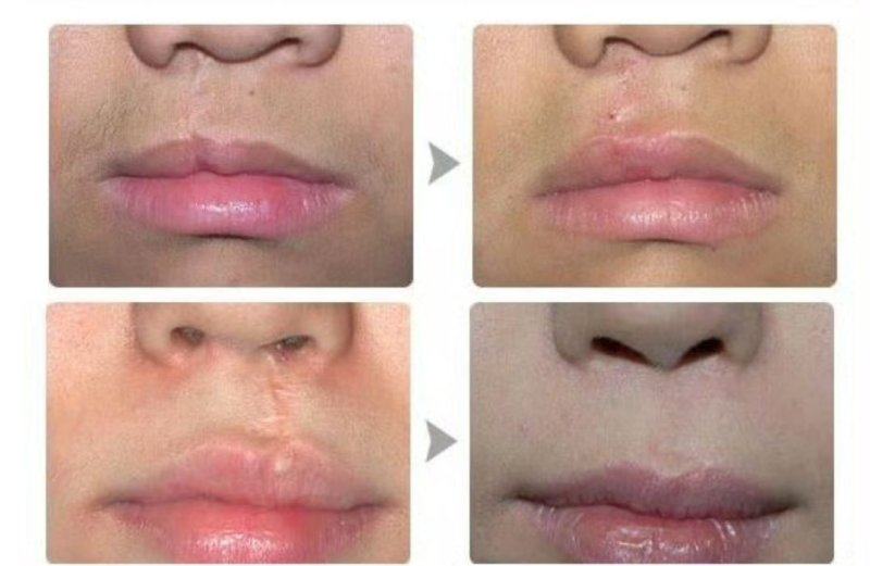 云南省中医医院皮肤科特色项目及技术优势