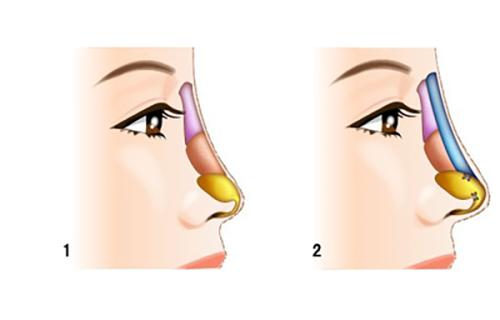 深圳正夫连锁口腔齿科真人口碑评价怎么样?