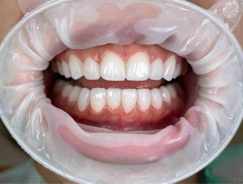 陕西咸阳秦都品一口腔诊所特色项目及技术优势