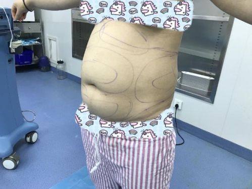 武汉白年医美整形收费价格表/收费标准