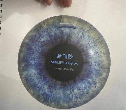 丰城爱尔眼科医院简介概述