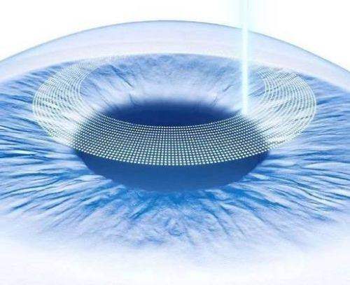 丰城爱尔眼科医院真人口碑评价