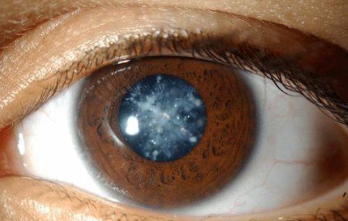 兰州阿玛施眼科医院真人口碑评价怎么样？