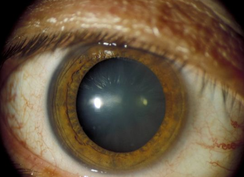 泰兴市人民医院眼科详细的预约挂号方式及流程