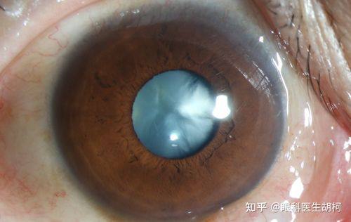 云南省妇幼保健院眼科详细的预约挂号方式及流程