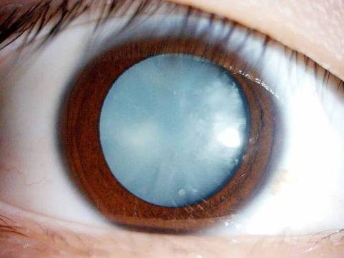 兰州阿玛施眼科医院简介概述