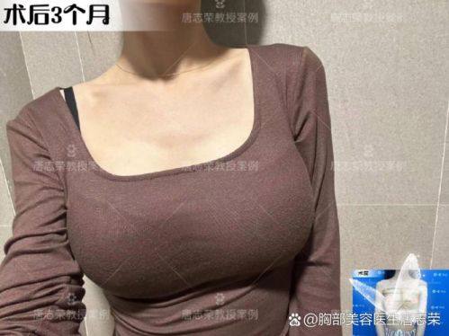 武汉白年医美整形真人口碑评价怎么样?