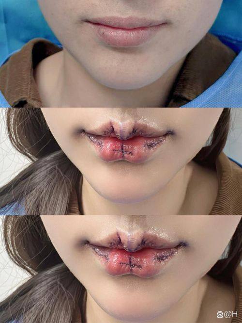 深圳世纪风华医疗美容诊所真人口碑评价怎么样?