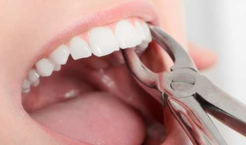 汕尾市振华口腔门诊部预约挂号方式及流程