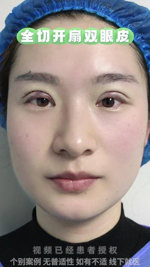 广州艾玛仕医疗美容门诊部特色项目及技术优势