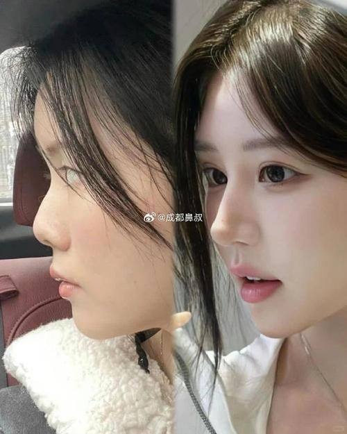 河南省人民医院整形美容科是正规医院吗？