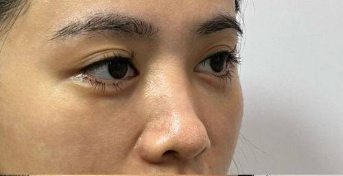 韩国江南知友医院真人口碑评价怎么样？