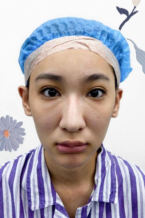 韩国江南知友医院收费价格表/收费标准