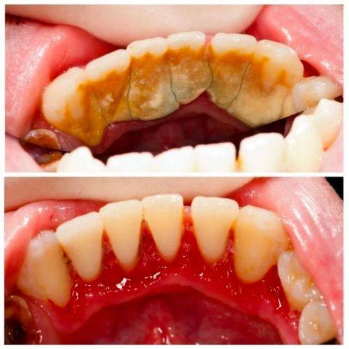 莆田市荔城区领跑口腔地址电话营业时间