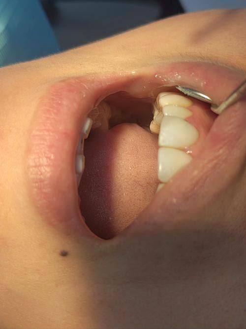 莆田市荔城区领跑口腔特色项目及技术优势