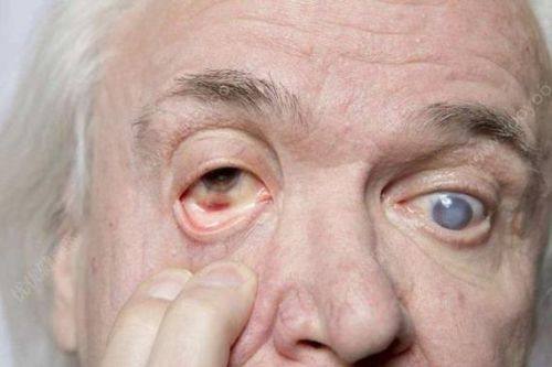 许昌市人民医院眼科真人口碑评价怎么样?