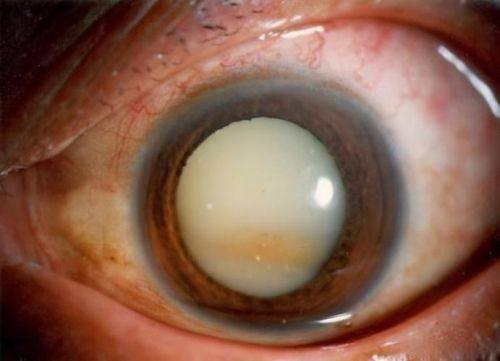 张家口市第一医院眼科地址电话营业时间