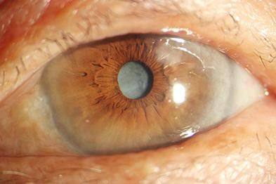 许昌市人民医院眼科特色项目及技术优势