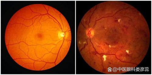 许昌市人民医院眼科地址电话营业时间