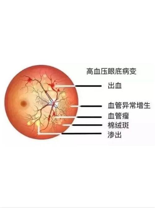 恩施爱尔眼科医院简介概述