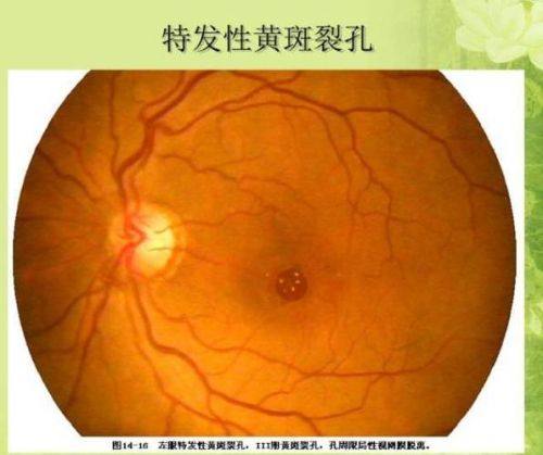 张家口市第一医院眼科真人口碑评价怎么样?