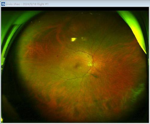 恩施爱尔眼科医院收费价格表/收费标准