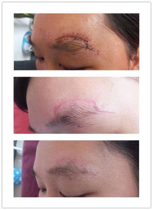 河南省人民医院整形美容科收费价格表/收费标准