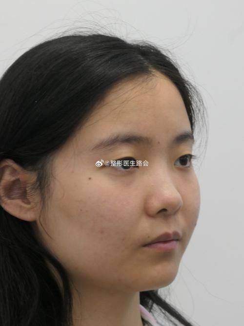 上海槿馨医疗美容是正规医院吗？