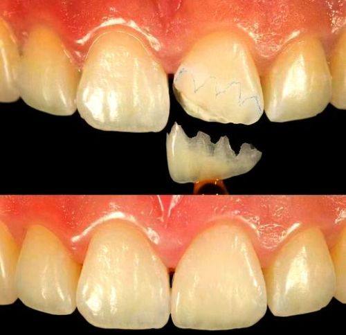 莆田市荔城区领跑口腔详细的预约挂号方式及流程