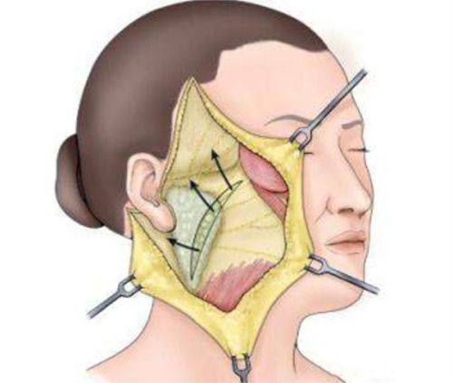 李采璘医生预约挂号
