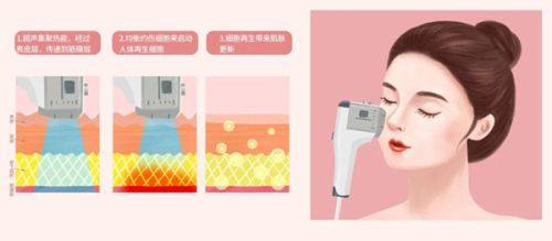 金会原医生口碑评价及真人实例