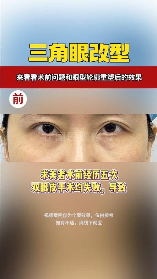 珠海一韩医疗整形医院真人口碑评价怎么样？