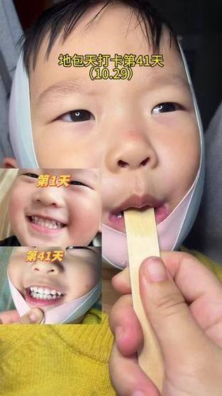 遵义丽齿口腔门诊部详细的预约挂号方式及流程