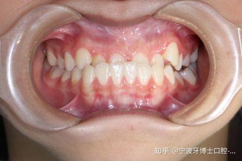 蓬莱马军口腔诊所真人口碑评价怎么样?