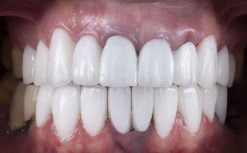 宁波金诺口腔地址电话营业时间