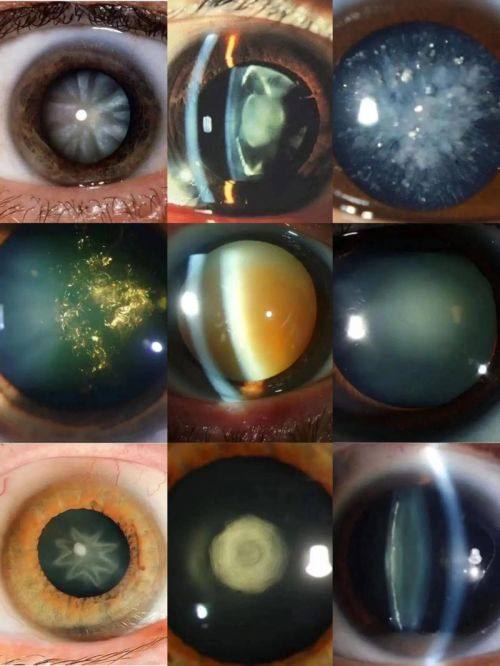 邢台市第三医院眼科医生团队实力强大及骨干医生简介