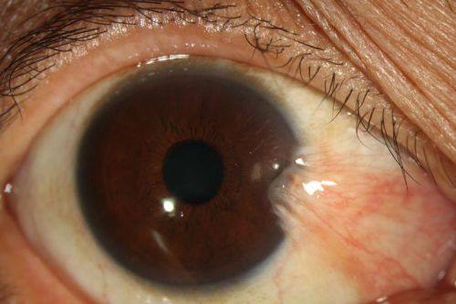 安徽中 医 药大学第一附属医院眼科是正规医院吗?