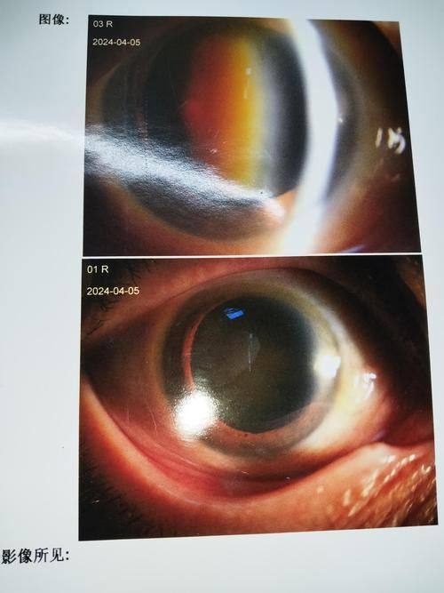 乐山爱尔眼科医院详细的预约挂号方式及流程