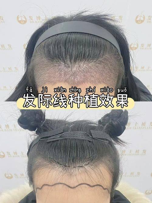 云南新华医院详细的预约挂号方式及流程