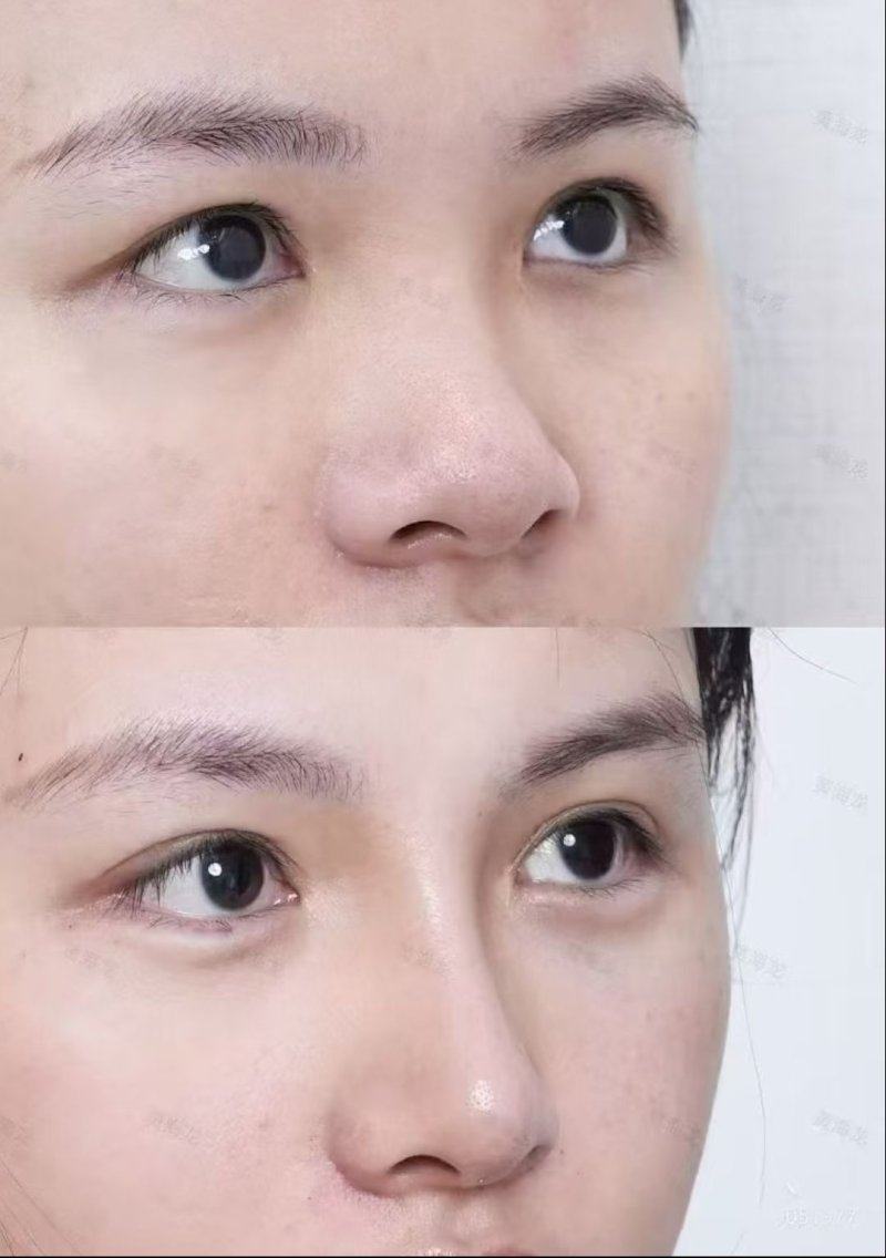 丹东盛美艳医疗美容诊所真人口碑评价怎么样？