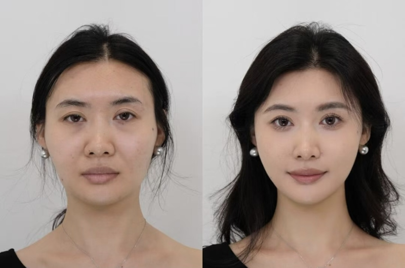 李采璘医生坐诊医院