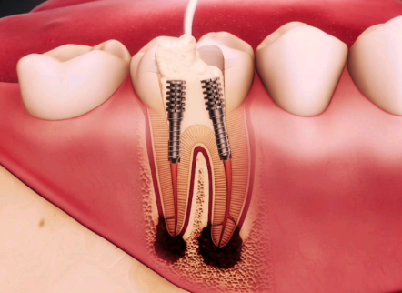 宁波金诺口腔特色项目及技术优势