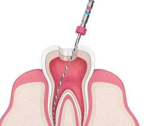 中山余双莲口腔详细的预约挂号方式及流程