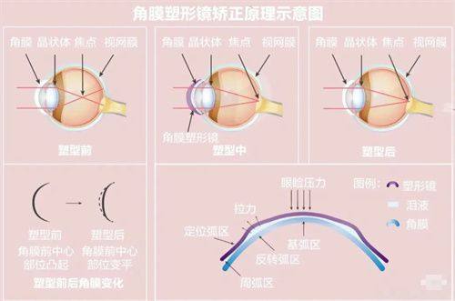 韩国首尔SB眼科整形医生团队实力强大及骨干医生简介