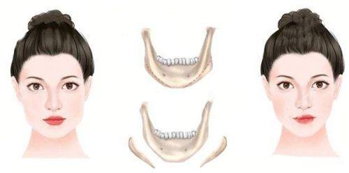 李采璘院长价格表