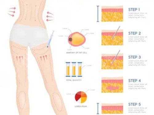 李采璘院长口碑评价及真人实例