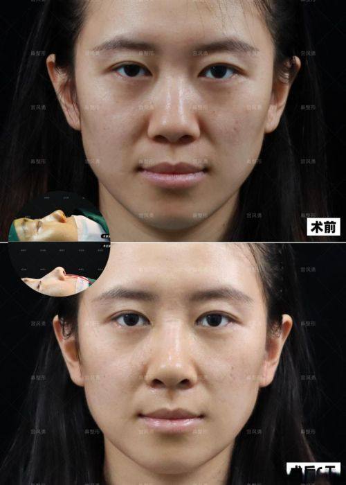 上海复大医院整形（皮肤科）特色项目及技术优势