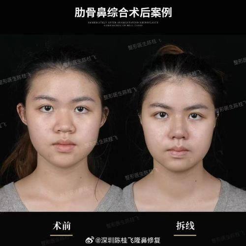 南京杏仁医疗美容门诊部收费价格表/收费标准